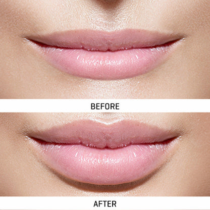 World's First At-Home Professional LED Lip Therapy Device