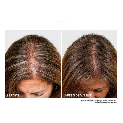 Cordless Hair Growth Comb